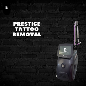 prestige-laser-tattoo-removal-machine
